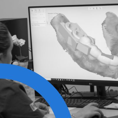 3D Dental Guides